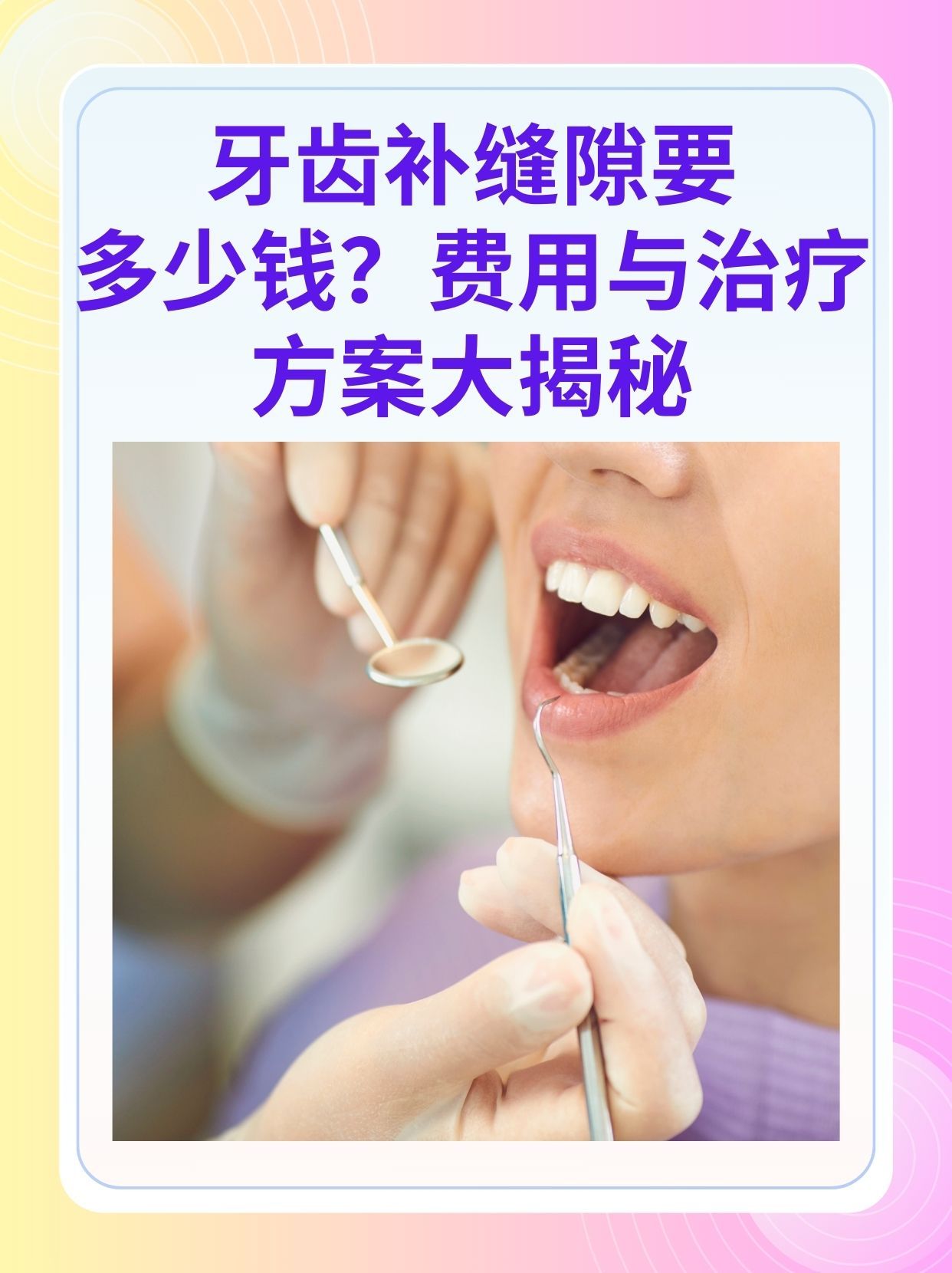 陇南补牙医保可以报销吗(补牙医保可以报销吗 哪些可以报销呢)